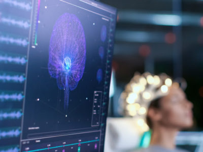 Bild eines Gehirnwellenscanners